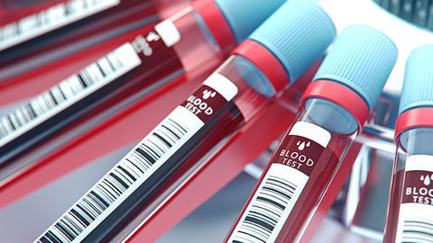 Blood Tubes, Labs