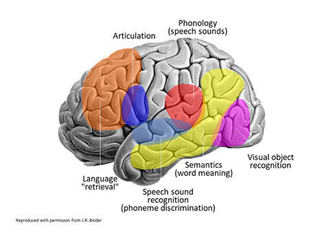 Brain Diagramming Area Functions for Aphasia 