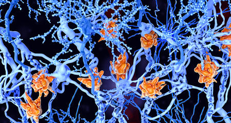 multiple sclerosis microglia cells