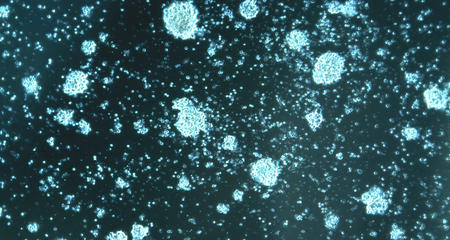 CAR T Cells Growing in Culture