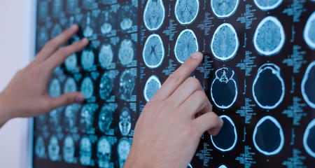 X-ray images of human brain on whiteboard