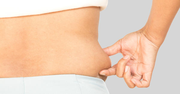 Woman pinching side fat - Coolsculpting Liposuction Treatment