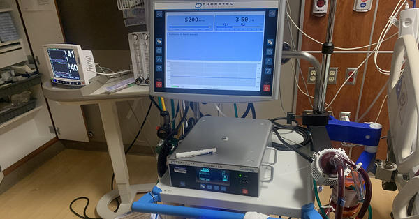 ECMO machine for COVID-19 patients